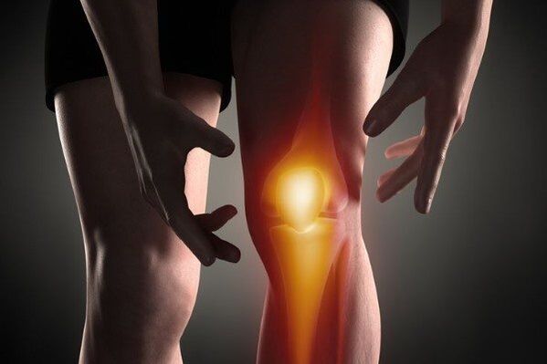 Knee joint osteoarthritis