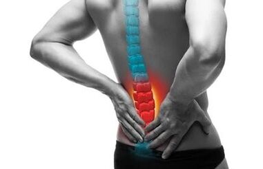 Osteochondrosis is a disease of the spine.