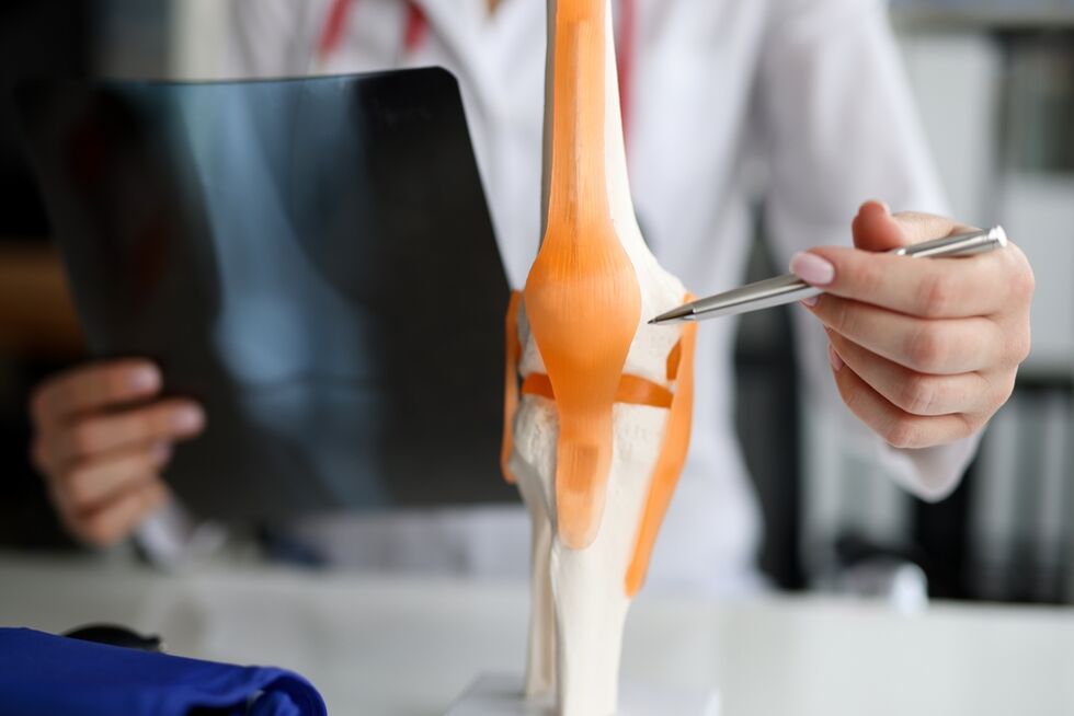 Demonstration of a joint in which degenerative changes lead to the development of osteoarthritis.